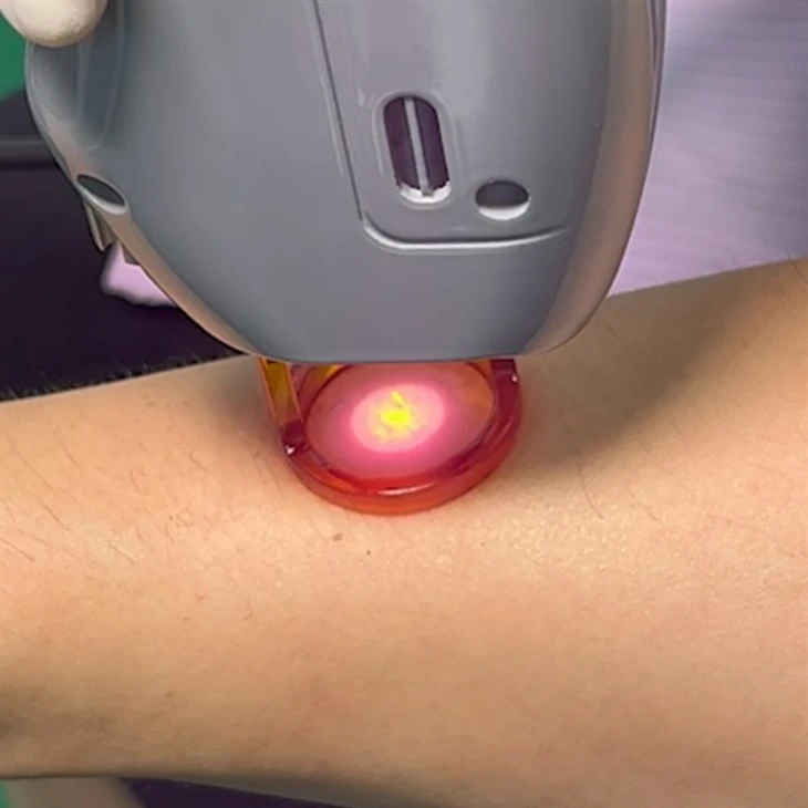 755nm 1064nm Double Wave Alexandrite Laser Hair Removal Machine