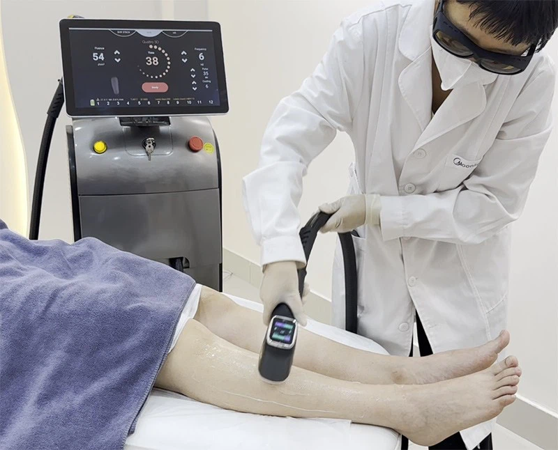 Laser Hair Removal Soprano Ice Machine suppliers