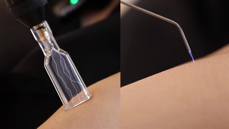 New Plasma Beauty Machine Fusion Plasma System high quality